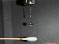 Wattest�bchen - HIV, AIN und das Analkarzinom