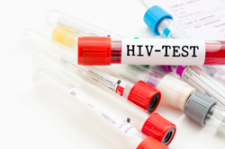 HIV / AIDS-News >> HIV in Düsseldorf, AIDS in Düsseldorf , Hausarzt